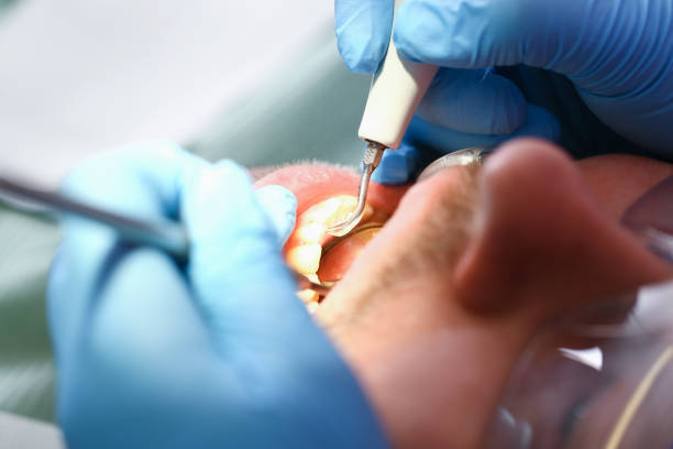 Best Emergency Treatment for Dental Infections or Abscesses in Dickson City, PA