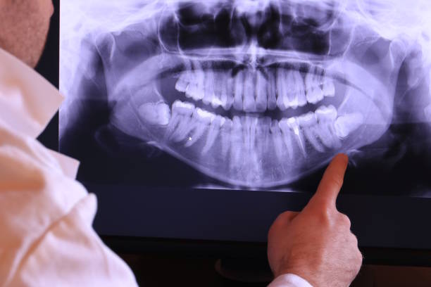 Best Emergency Treatment for Dental Infections or Abscesses in Dickson City, PA