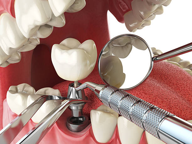 Best Emergency Gum Treatment in Dickson City, PA